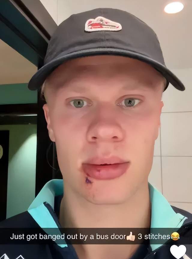 http, 迎来足球生, 肌肉拉伤 http, 迎来足球生, 肌肉拉伤